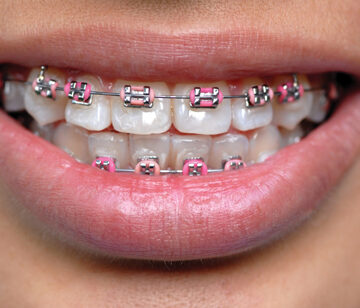 عيادة تقويم اسنان في القاهرة، افضل عيادة تقويم اسنان بالقاهرة، احسن عيادة تقويم اسنان في القاهرة، عيادة تقويم اسنان شاطرة في القاهرة، عيادة تقويم اسنان قريبة مني القاهرة، اسعار تقويم الاسنان في عيادة بالقاهرة، حجز عيادة تقويم اسنان القاهرة، عيادة تقويم اسنان اطفال في القاهرة، مركز تقويم اسنان في القاهرة، دكتور تقويم اسنان في عيادة بالقاهرة