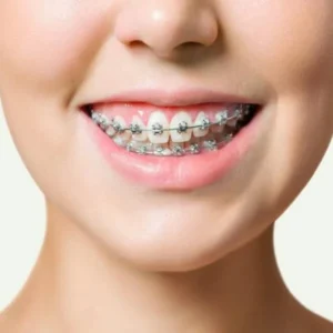 دكتور تقويم اسنان في القاهرة، احسن دكتور تقويم اسنان في القاهرة، دكتور تقويم اسنان شاطر في القاهرة، تقويم اسنان القاهرة، دكتور تقويم اسنان قريب مني القاهرة، اسعار تقويم الاسنان في القاهرة، عيادة تقويم اسنان في القاهرة، دكتور تقويم اسنان اطفال في القاهرة، افضل عيادة تقويم اسنان بالقاهرة، حجز دكتور تقويم اسنان القاهرة